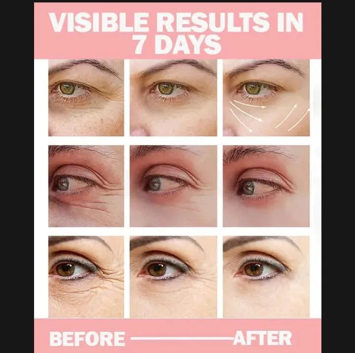 Anti Dark Circle Eye Cream