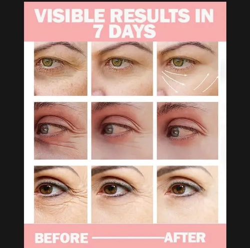 Anti Dark Circle Eye Cream